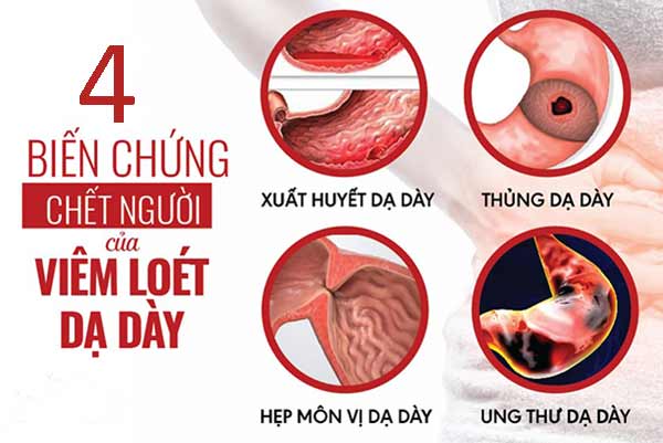 1. Nguyên nhân chính của xuất huyết dạ dày