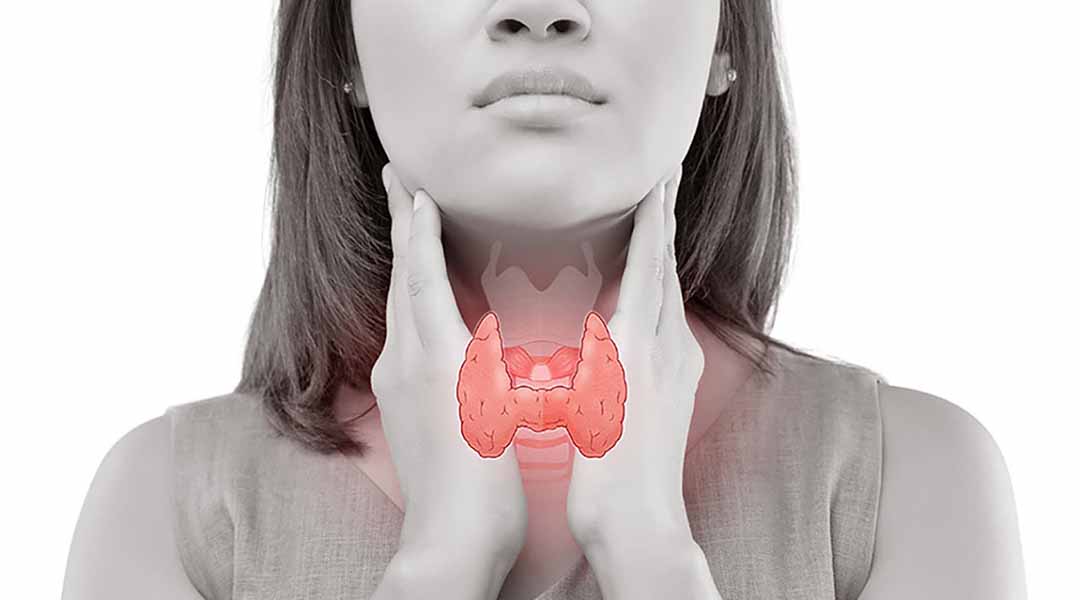 Nguyên nhân, dấu hiệu và cách điều trị bệnh suy giáp