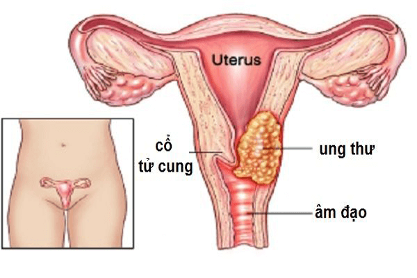 Phương pháp chẩn đoán và điều trị