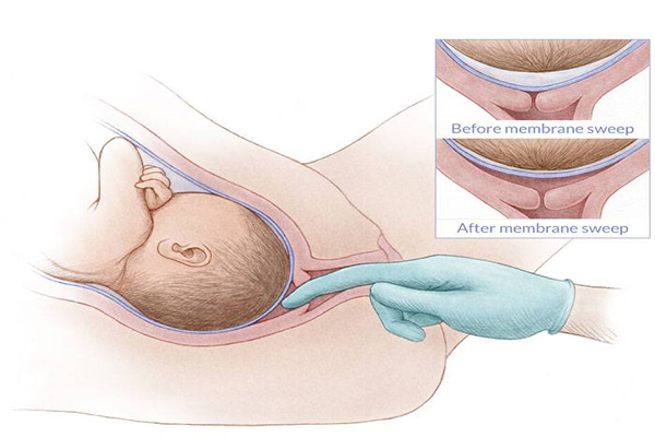 Tử cung mở 2cm khi nào sinh? Dấu hiệu và những lưu ý quan trọng