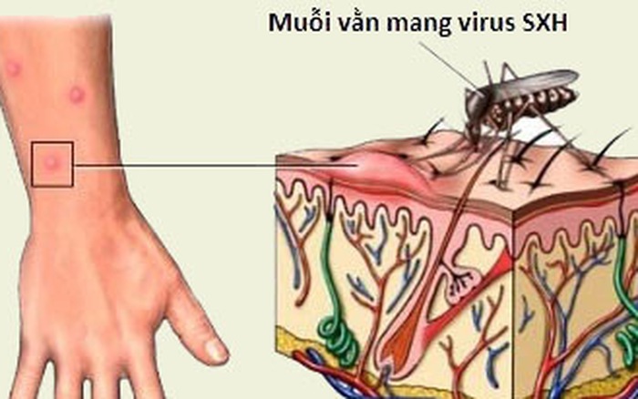 Muỗi vằn mang virut Sốt xuất huyết