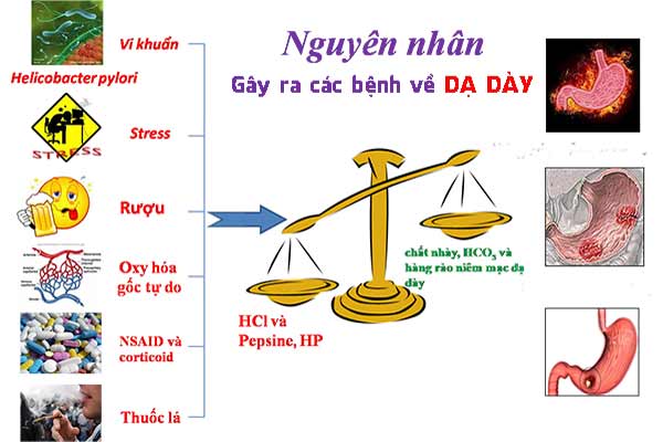 Nguyên nhân gây đau dạ dày: Hiểu rõ và phòng ngừa hiệu quả