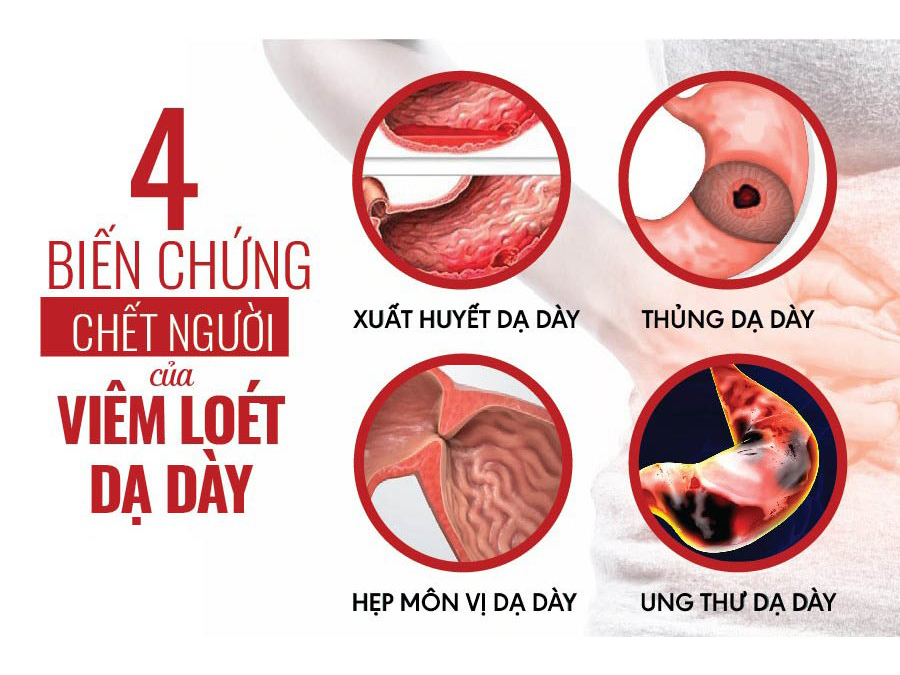 Các biến chứng nguy hiểm của viêm loét dạ dày