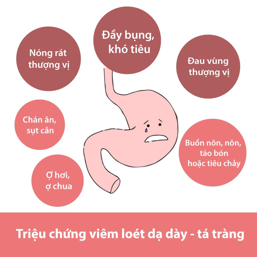 biểu hiện triệu chứng viên loét tá tràng 