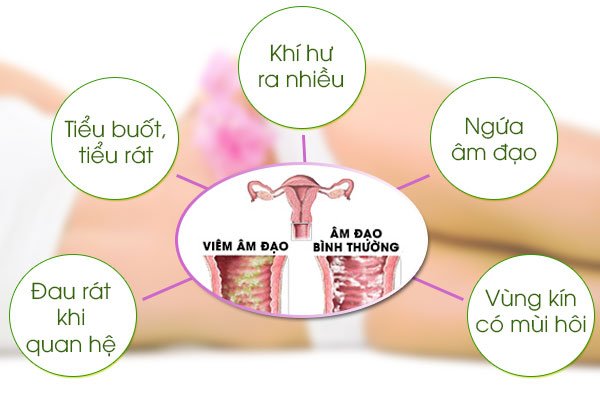 4. Biện pháp phòng ngừa bệnh phụ khoa