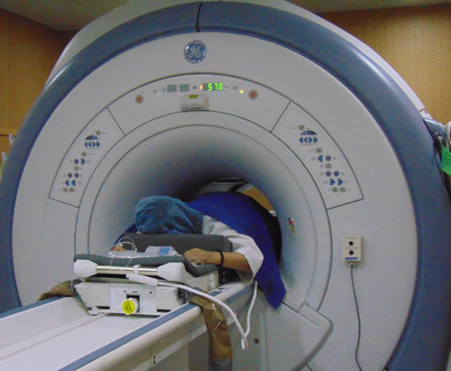 Bệnh nhân trong quá trình điều trị u xơ tử cung bằng công nghệ FUS-MRI.