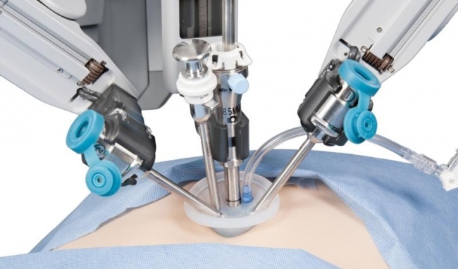 Phẫu thuật cắt túi mật bằng phương pháp mổ nội soi