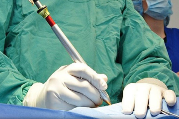 Phẫu thuật phì đại tuyến tiền liệt sử dụng dao lưỡng cực hay laser