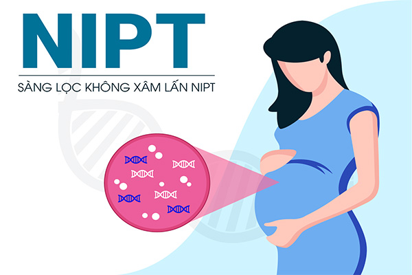 Dịch vụ xét nghiệm sàng lọc trước sinh NIPT