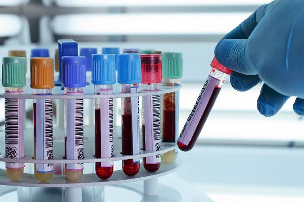 Xét nghiệm máu của các xét nghiệm trong thai kỳ
