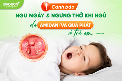 Trẻ ngủ ngáy, há miệng, ngưng thở khi ngủ: Cảnh báo Amidan/VA quá phát