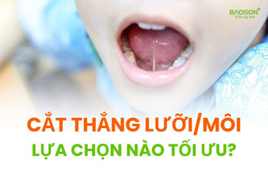 Cắt thắng lưỡi/môi: Phương pháp nào là lựa chọn tối ưu?