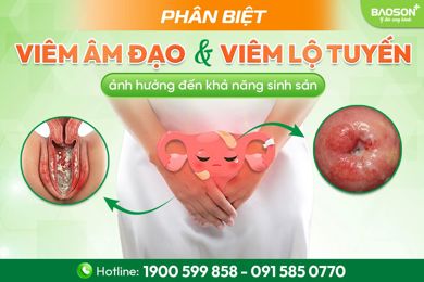 Phân biệt viêm âm đạo và viêm lộ tuyến cổ tử cung: Nhận diện đúng để tránh biến chứng