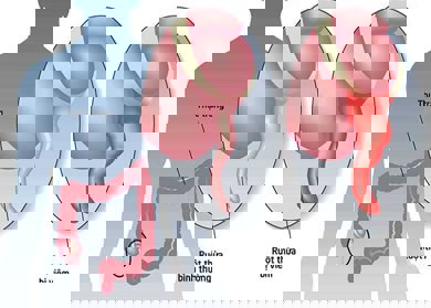 Phẫu thuật Nội soi viêm ruột thừa
