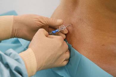 “Đẻ không đau” và những điều mẹ bầu cần biết