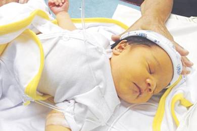 Vàng da sơ sinh - bố mẹ không nên chủ quan!