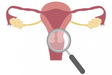 4 dấu hiệu viêm lộ tuyến cổ tử cung chị em nào cũng bỏ qua