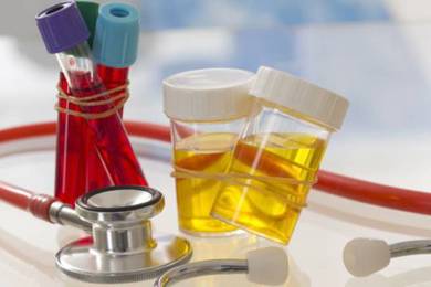 Vì sao cần xét nghiệm nước tiểu khi mang thai?