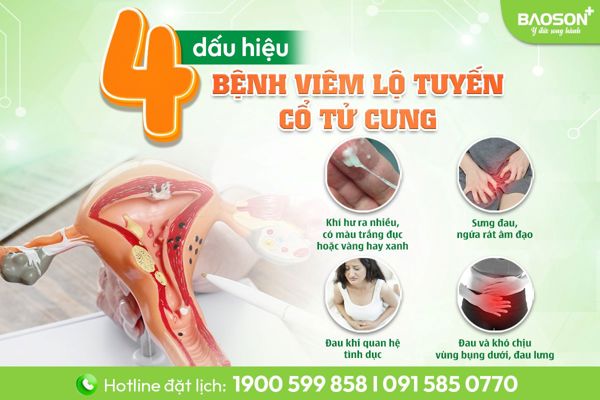 4 dấu hiệu Viêm lộ tuyến ảnh hưởng đến khả năng mang thai
