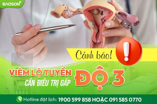 Cảnh báo viêm lộ tuyến cổ tử cung độ 3: Cần điều trị sớm để tránh biến chứng nguy hiểm