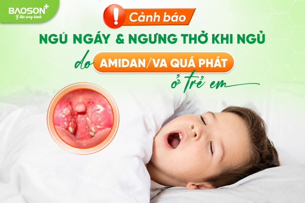 Trẻ ngủ ngáy, há miệng, ngưng thở khi ngủ: Cảnh báo Amidan/VA quá phát