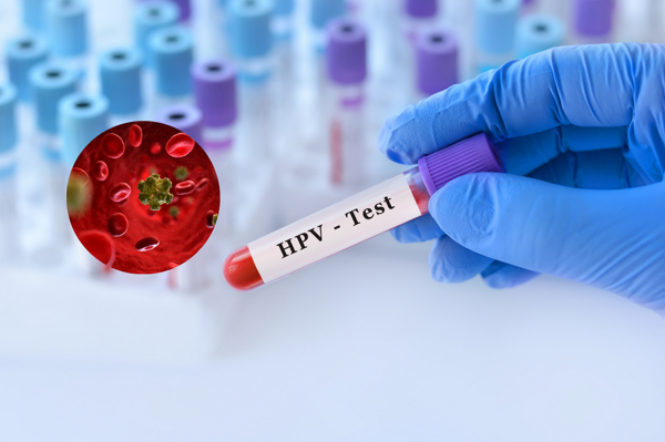 HPV - Mối nguy thường trực với 80% phụ nữ và cách bảo vệ bản thân hiệu quả nhất