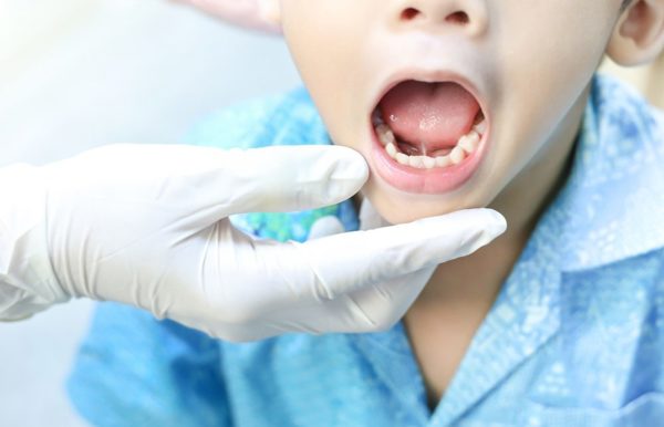 Cắt thắng lưỡi - Đừng bỏ lỡ 