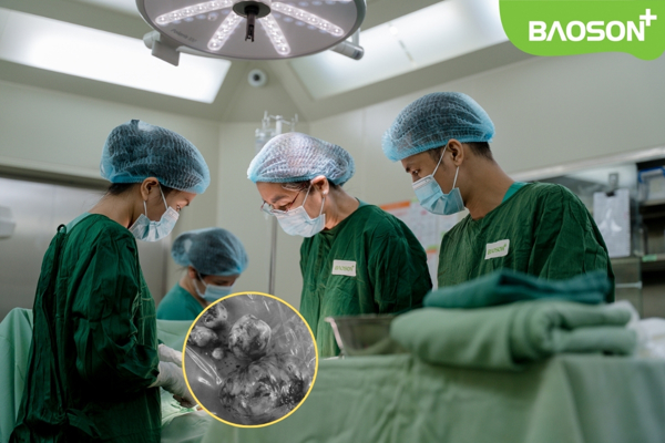 Thỉnh thoảng đau bụng kinh nhẹ, cô gái bất ngờ phát hiện 5 khối u xơ “khủng” trong tử cung