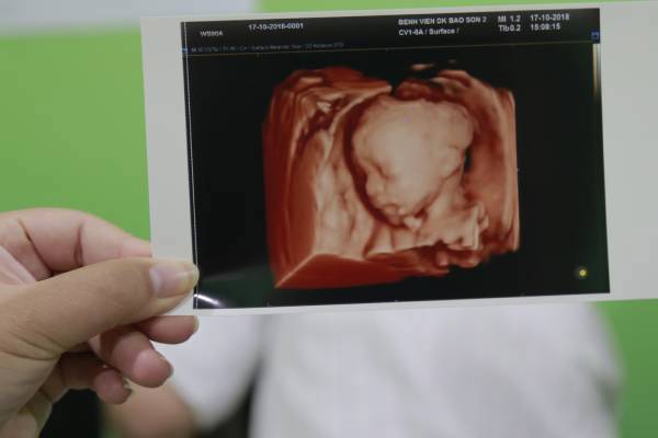 Ý nghĩa và tại sao nên siêu âm thai trong quá trình thai kỳ