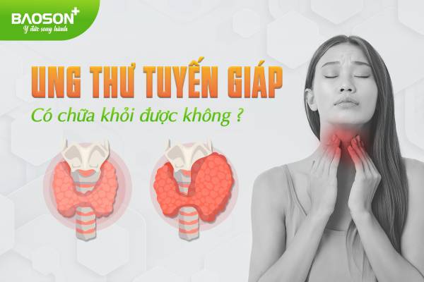 Ung thư tuyến giáp có chữa khỏi được không?
