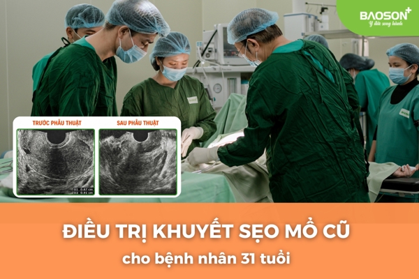 Phẫu thuật điều trị khuyết sẹo mổ: Chấm dứt rong kinh kéo dài, mở ra cơ hội mang thai trở lại cho bệnh nhân 31 tuổi